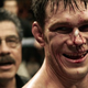 Illustration for article titled "It Looked Like A Butterflied Shrimp": A Cutman's Tour Of 12 Terrible Fight Wounds